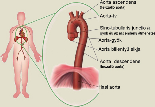 Az aorta anatómiáját, lefutását bemutató ábra.